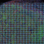 A tumor, looking like a colored blob, in the cellview environment which divides it up into hundreds of tiny rectangles