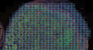 A tumor, looking like a colored blob, in the cellview environment which divides it up into hundreds of tiny rectangles